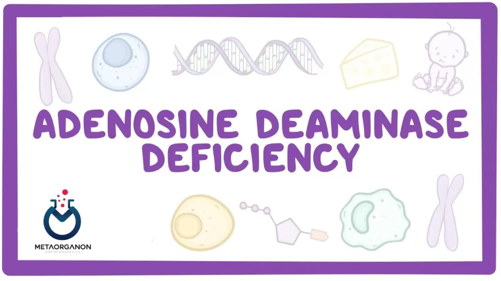 آزمایش آدنوزین دآمیناز (ADA) | Adenosine Deaminase