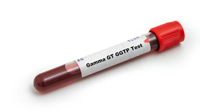آزمایش گاما گلوتامیل ترانسفراز GGT