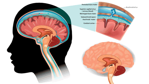 آزمایش آنالیز مایع مغزی نخاعی (CSF) | Spinal Fluid Analysis | Cerebrospinal Fluid