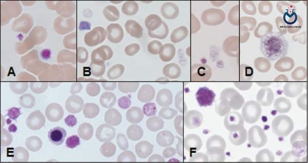 اندکس نسبت سلول های بزرگتر پلاکت (P-LCR) یا Platelet larger cell ratio