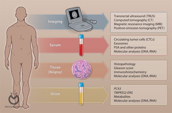 Prostate cancer specific biomarkers