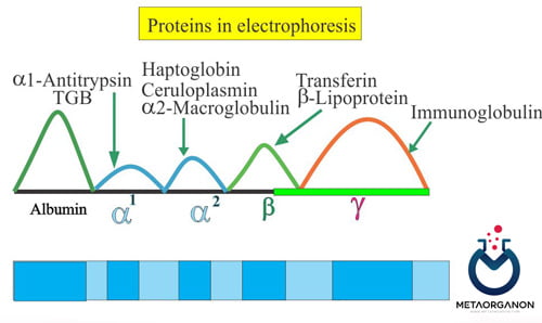 الکتروفورز پروتئین