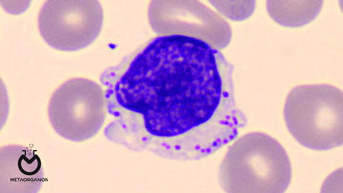T-cell-large-granular-lymphocytic-leukemia)