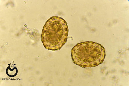 ascaris-lumbricoides