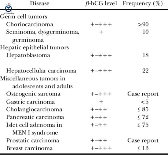 hCG مرتبط با تومورهای بدخیم