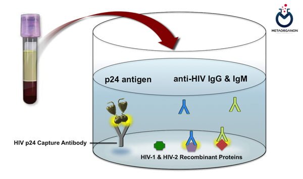 آزمایش آنتی بادی و آنتی ژن HIV به روش ایمونواسی کمی لومینسانس