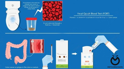 آزمایش خون مخفی مدفوع | آزمایش گایاک | HemoQuant