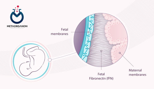 آزمایش فیبرونکتین جنینی (fFN) | Fetal Fibronectin