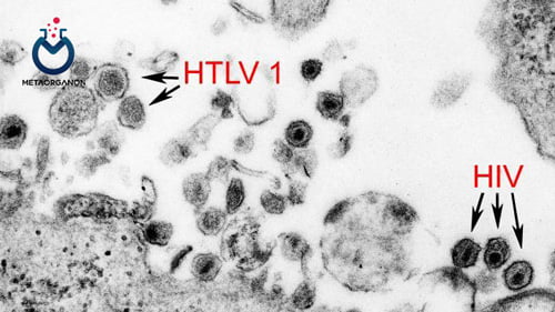 آزمایش ویروس لنفوتروپیک سلول T انسانی (HTLV) | ویروس Human T-cell Lymphotropic Virus | HTLV-1