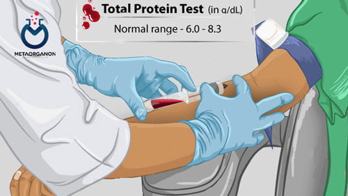 آزمایش پروتئین کل سرم | نسبت آلبومین به گلوبولین (A/G) | Total protein serum | Albumin to Globulin Ratio