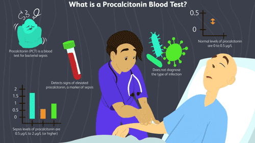 آزمایش پروکلسی تونین (PCT) | Procalcitonin