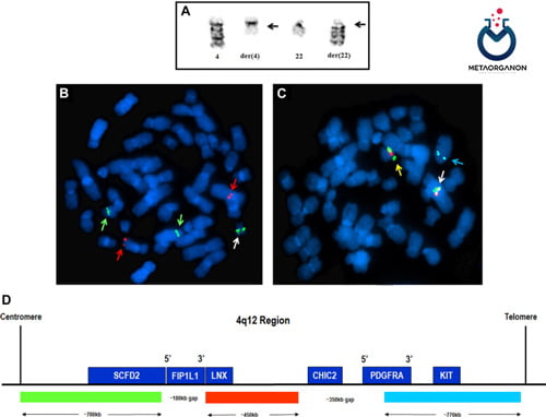 آزمایش ژن FIP1L1-PDGFRA به روش هیبریداسیون درجا فلورسانس (FISH)