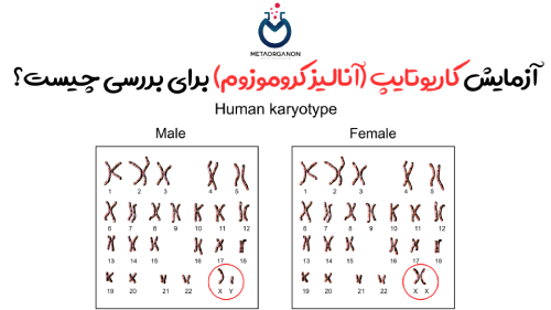 آزمایش کاریوتایپ | آنالیز کروموزوم | سایتوژنتیک | Karyotype | chromosome analysis