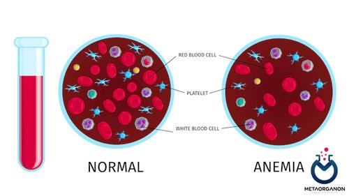 آزمایش کم خونی | آنمی | Anemia