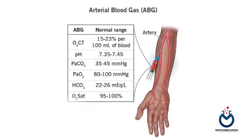 آزمایش گازهای خون | گاز خون شریانی | گاز خون وریدی