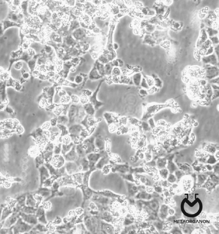 اثرات سیتوپاتیک (CPE) در کشت سلولی برای تشخیص روتاویروس 