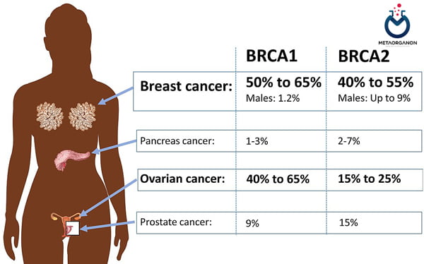 احتمال ابتلا به انواع سرطان در جهش BRCA 