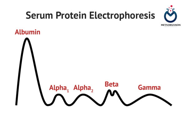 الکتروفورز-پروتئین-سرم
