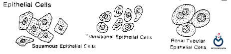 انواع سلول اپیتلیال در ادرار