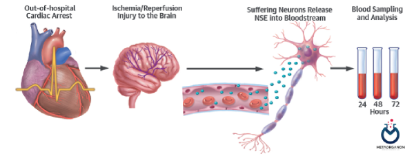 انولاز اختصاصی نورون (NSE) و ایست قلبی