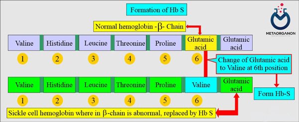 تشکیل Hb S در کم خونی سلول داسی شکل