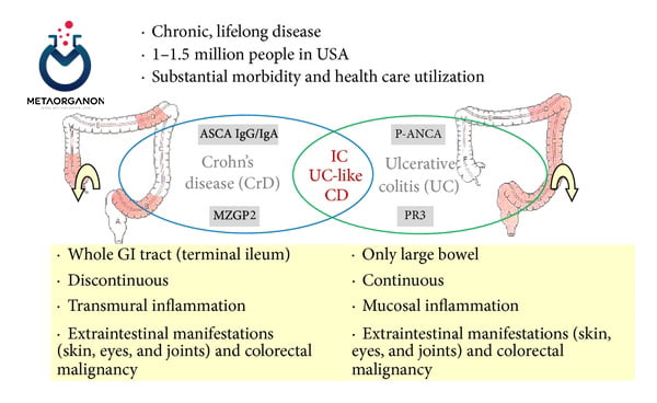 تفاوت ASCA و ANCA در بیماری کرون (CD) و کولیت اولسروز (UC)