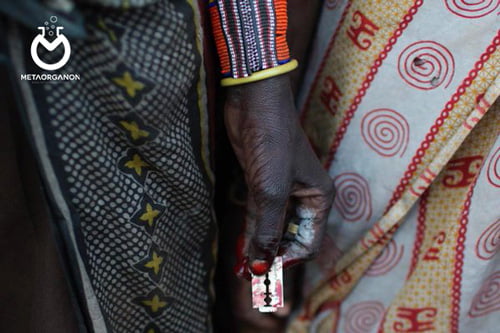روز جهانی مقابله با ناقص سازی (ختنه کردن) زنان | The International Day of Zero Tolerance for Female Genital Mutilation (FGM)