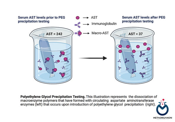 روش PEG precipitation برای تشخیص Macro-AST