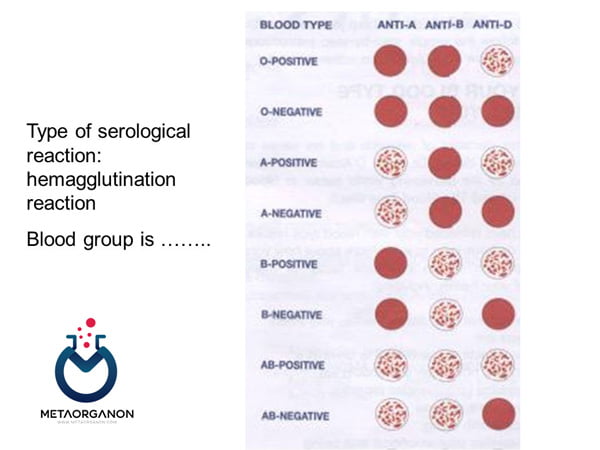 روش هماگلوتیناسیون برای تعیین گروه خون