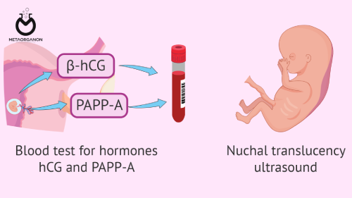 عوارض PAPP-A پایین در سه ماهه اول بارداری | پروتئین پلاسمایی A مرتبط با بارداری | Pregnancy-associated plasma protein-A