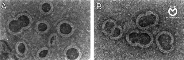 عکس میکروسکوپ الکترونی از سوراخ های ایجاد شده بر سطح گلبول های قرمز