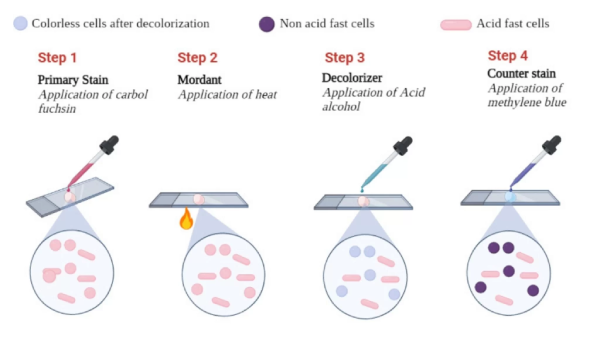 مراحل انجام آزمایش باسیل اسید فست (AFB)