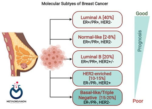 ساب تایپ های مختلف سرطان پستان