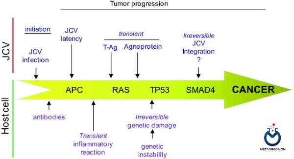نقش ویروس JC در پاتوژنز سرطان کولورکتال (CRC)