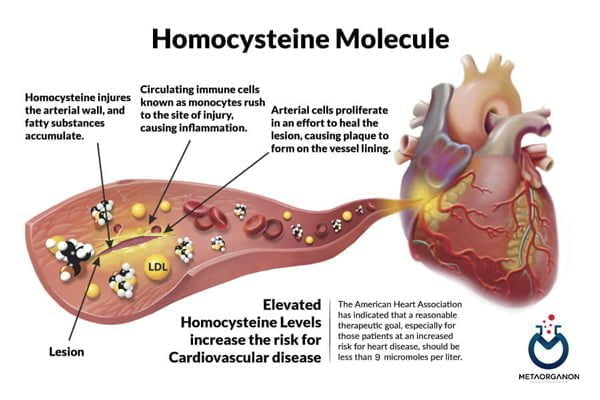هموسیستئین و بیماری های قلبی عروقی