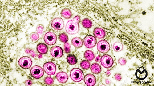 ویروس هرپس سیمپلکس (HSV)