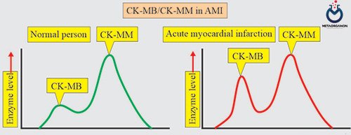 کراتین کیناز (CK) و CK-MB