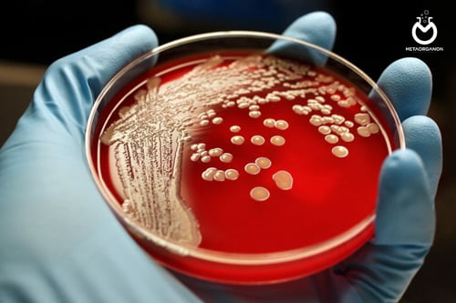 کشت-باکتریایی-استافیلوکوکوس-اورئوس-مقاوم-به-متی-سیلین-(MRSA)