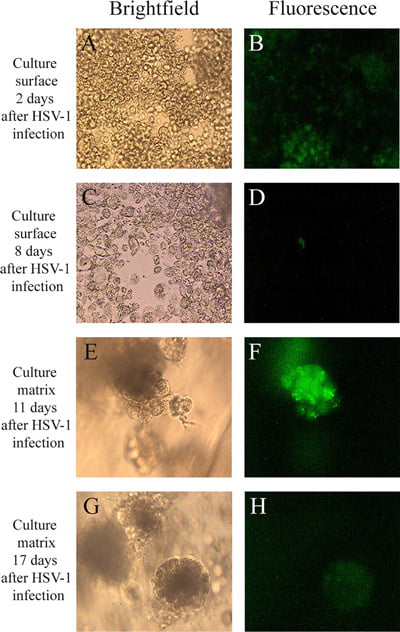 کشت ویروس هرپس سیمپلکس (HSV)
