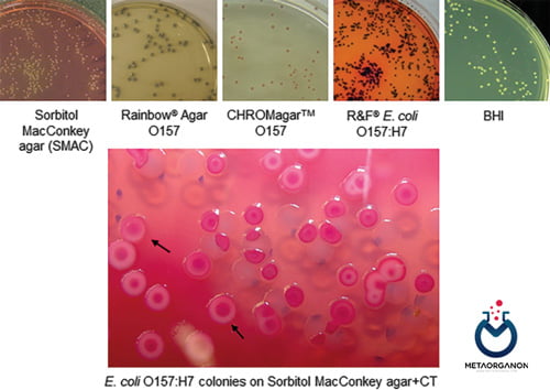 کلنی های مختلف E.coli بر روی محیط های مختلف